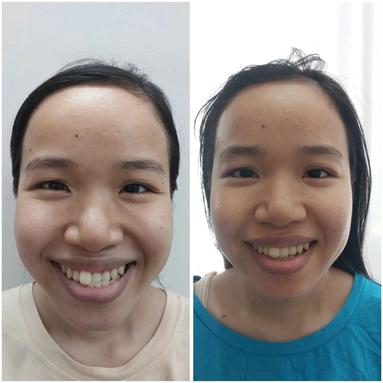 Danh mục album