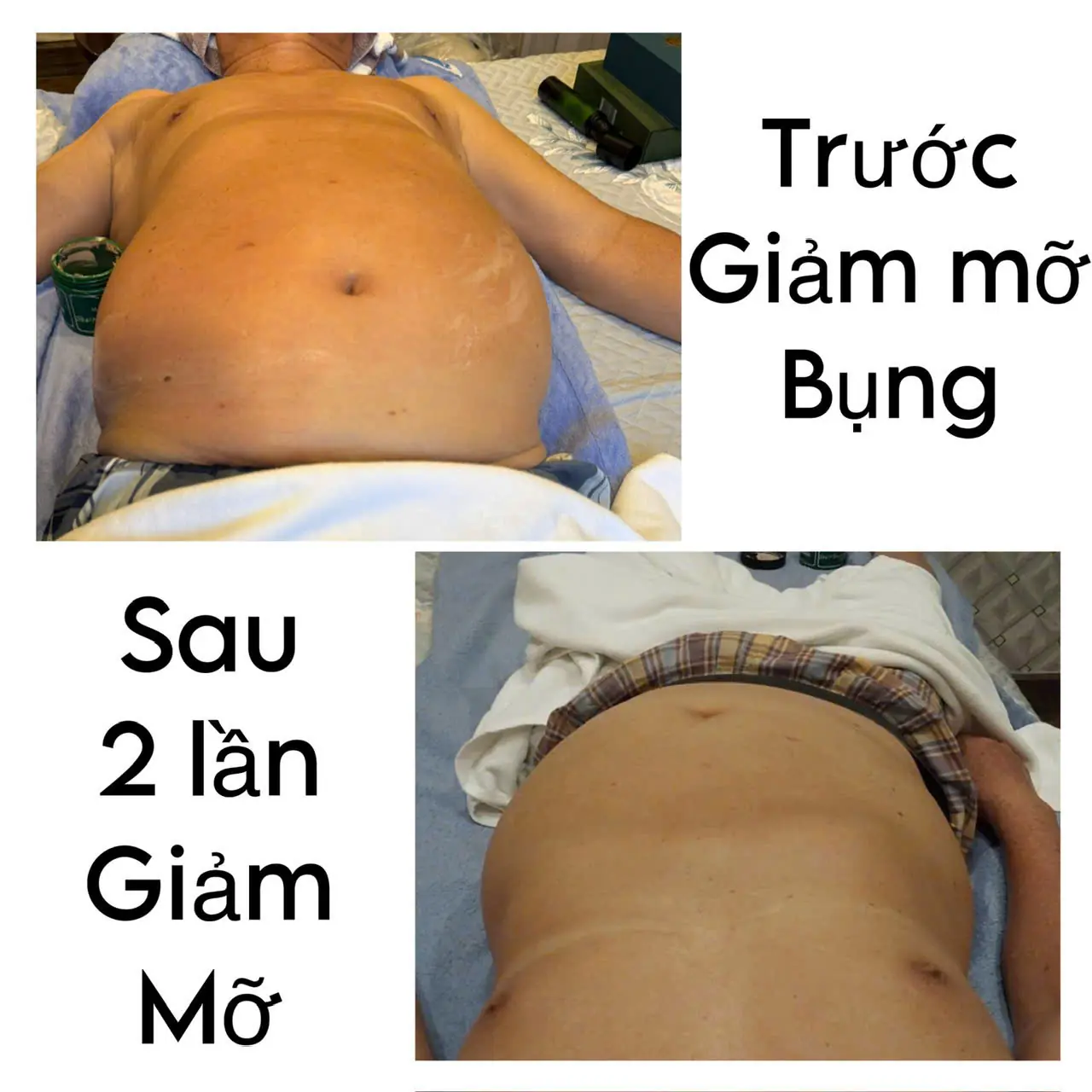 Danh mục album