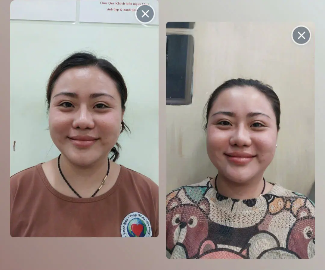 Danh mục album